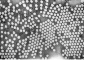polio Virus Uder TEM